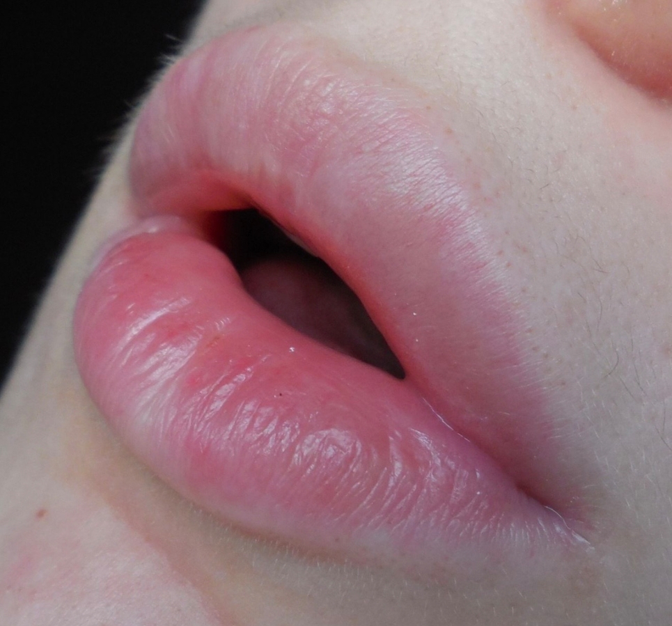 Губы как они есть