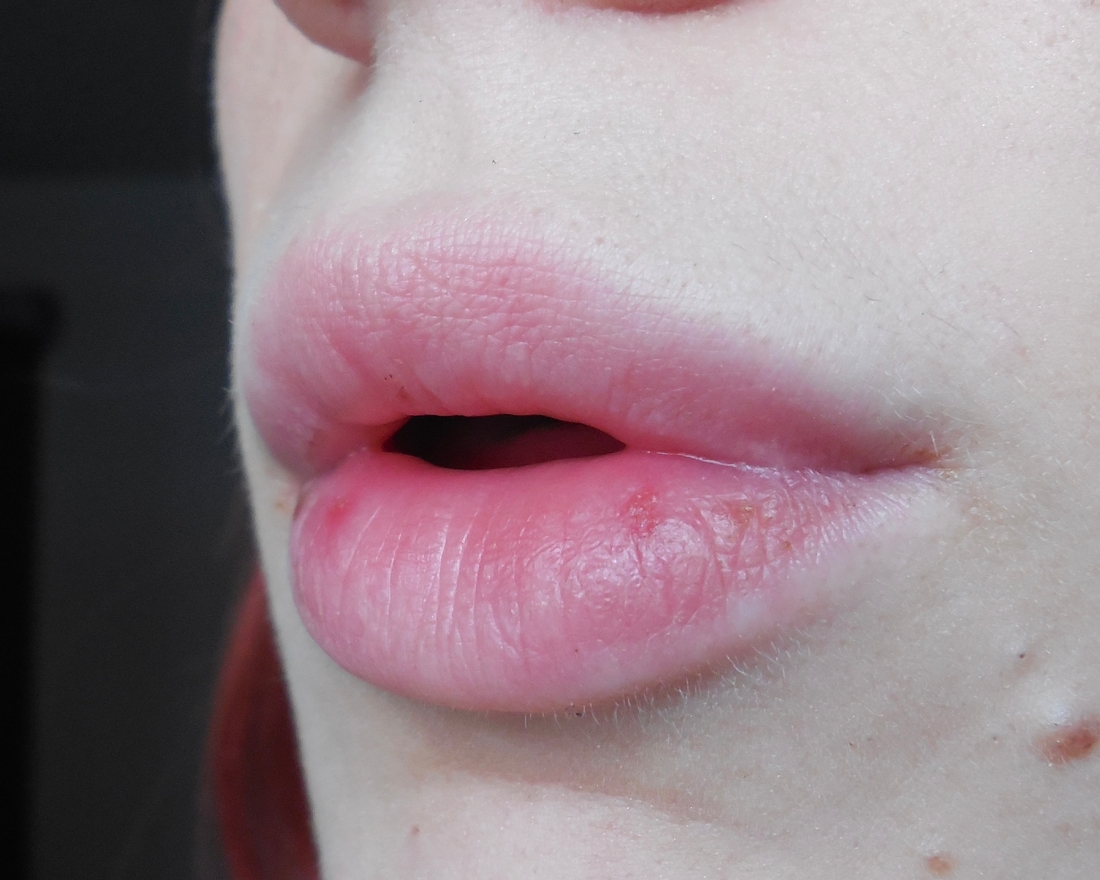 Губы как они есть