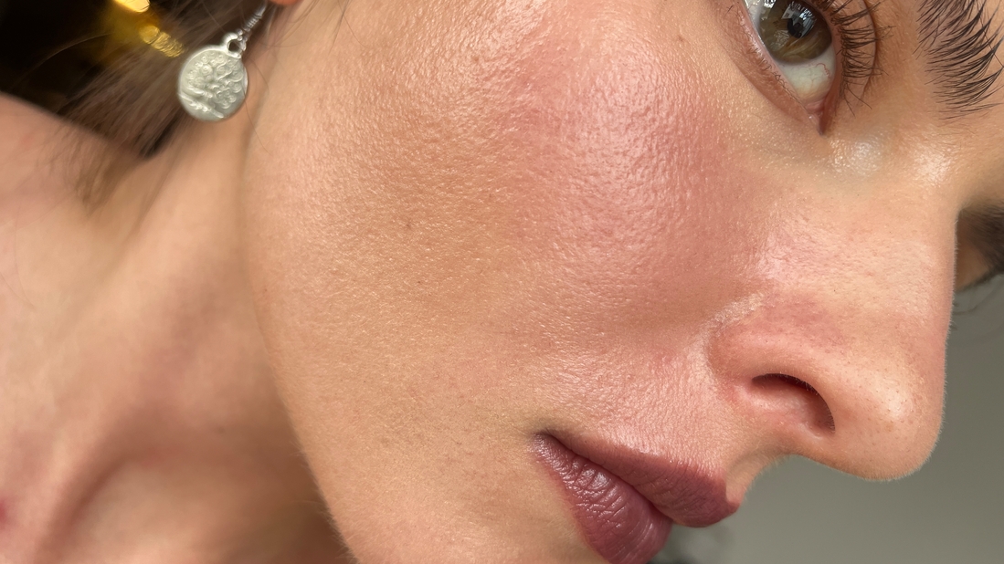 Кончик носа тоже как будто облез