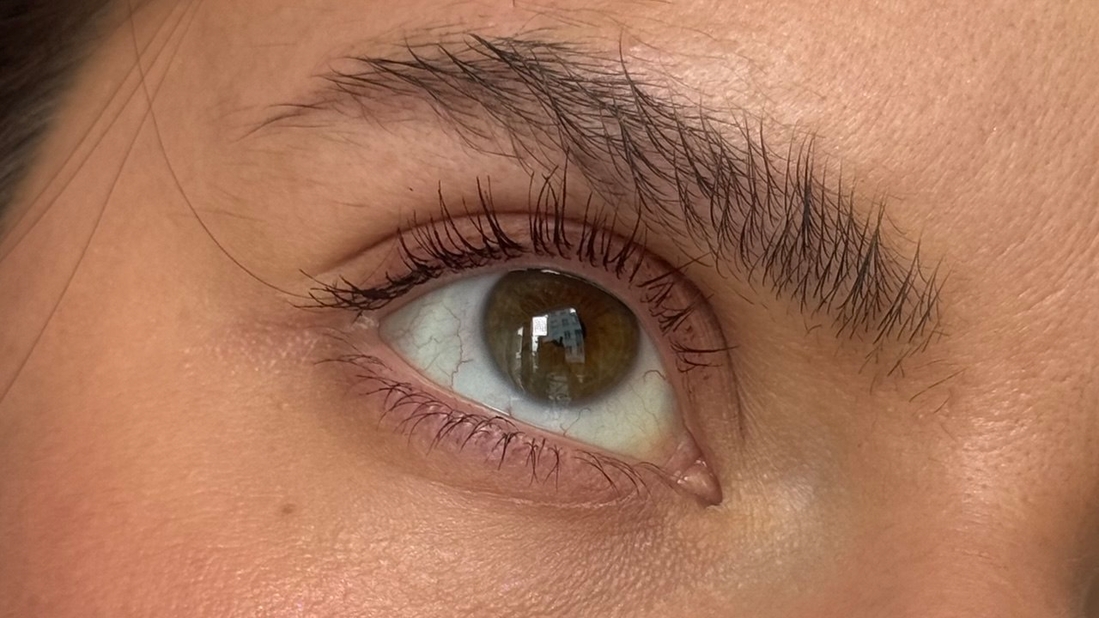 После керлера