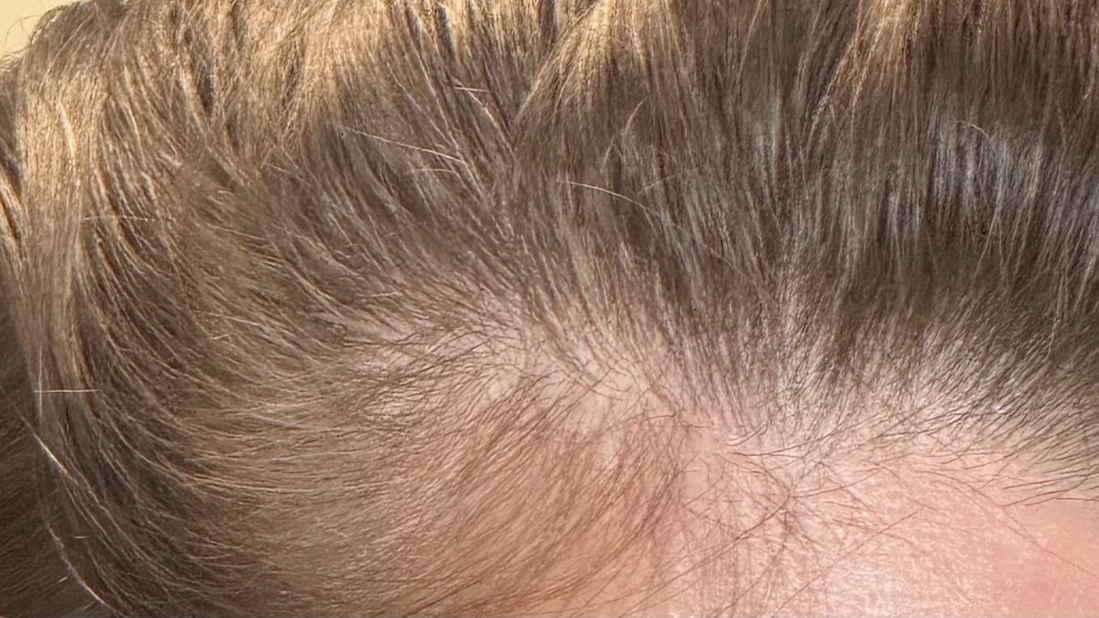 Такого у меня раньше не было - я вижу кожу головы)