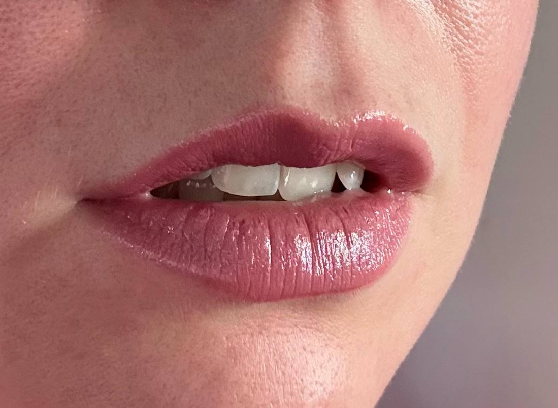 Оттенок 02 в тени.