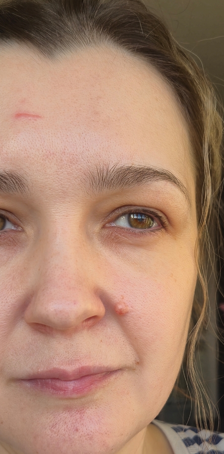 Лицо до макияжа при дневном свете