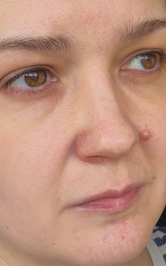Лицо без макияжа, ничего не скрыла) Кожа,скорее всего, комбинированная, 34 года, особых проблем нет, поры расширены, стандартный набор.
