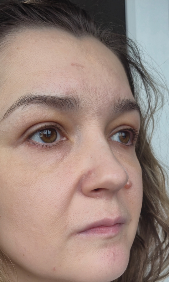 Наносим тональник и консилер точечно, не под глаза.