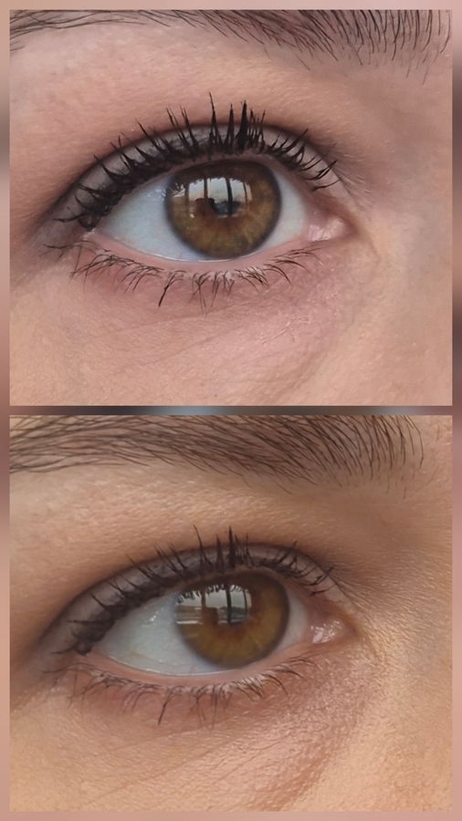 Сверху консилер, снизу консилер+ пудра