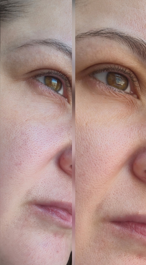 Слева до/справа после