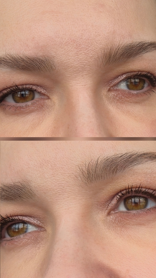 Сверху до, снизу после