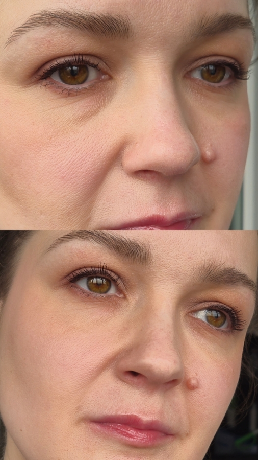 Сверху до пудры, снизу после