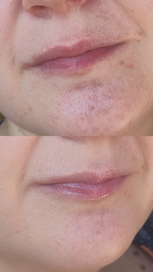 Простите за такие неэстетичные фото.