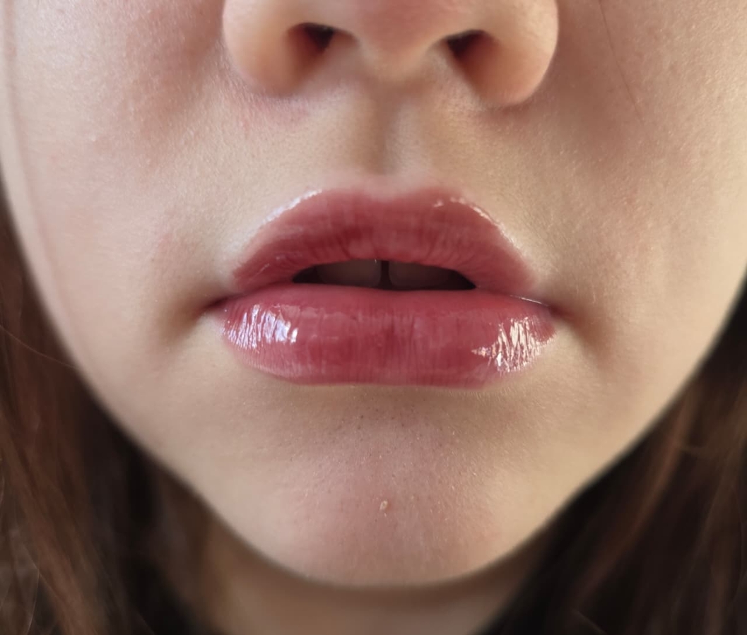 после нанесения