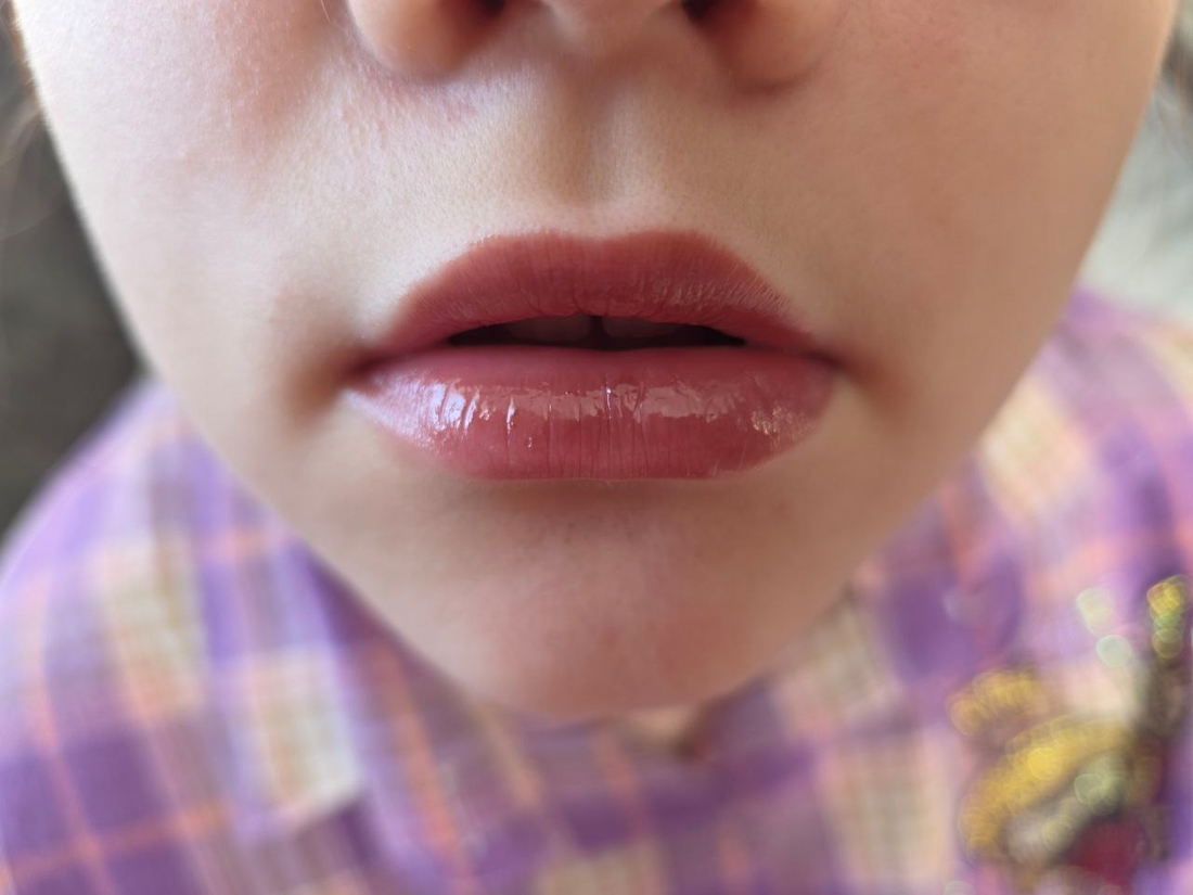 губы "после"