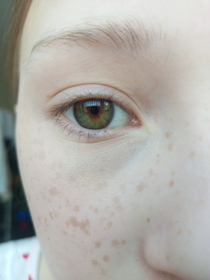 Фото консилера. Без праймера.