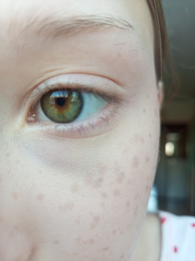 Фото консилера. С праймером. Без пудры.