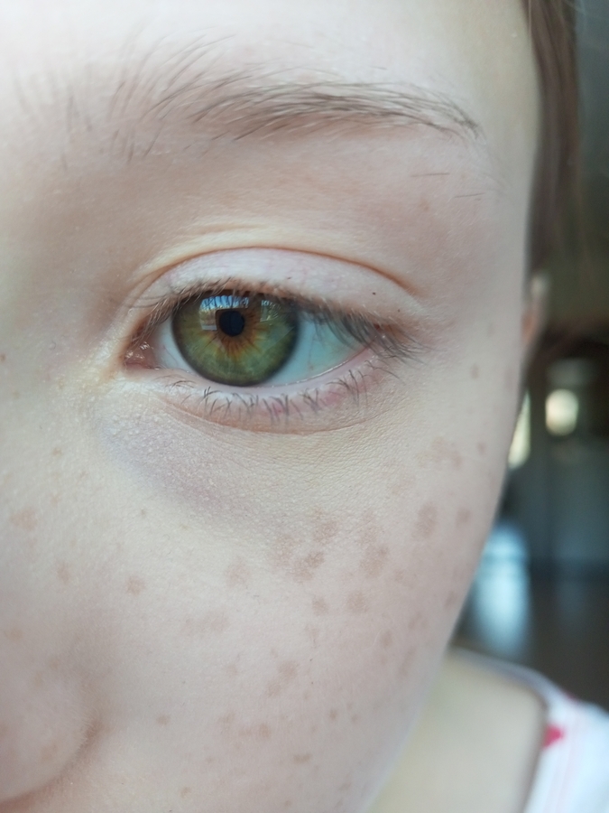 Фото консилера. С праймером. С пудрой.