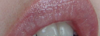 Король Коралловое Лето