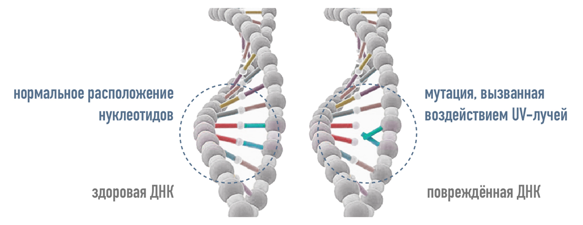 Мутагенез от действия ультрафиолета на ДНК клеток. Здоровая ДНК с нормальным расположением нуклеотидов и повреждённая ДНК с мутацией.